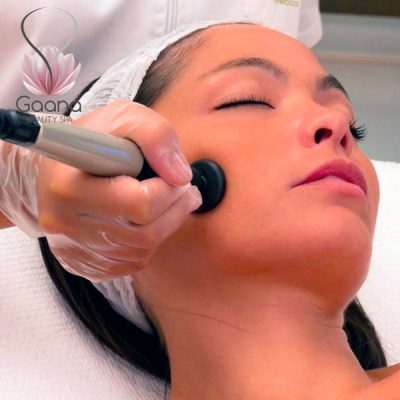 Trattamento con radiofrequenza