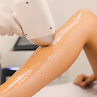 5 SEDUTE DI EPILAZIONE LASER